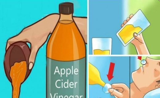 drink-apple-cider-vinegar-before-bed-because-you-will-treat-these-health-conditions-520x320-4108925